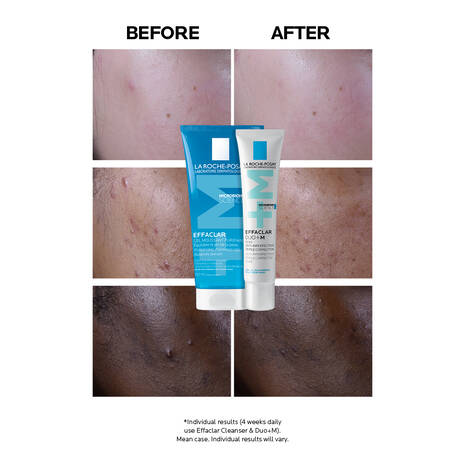 LA ROCHE POSAY EFFACLAR DUO+ M 40ML