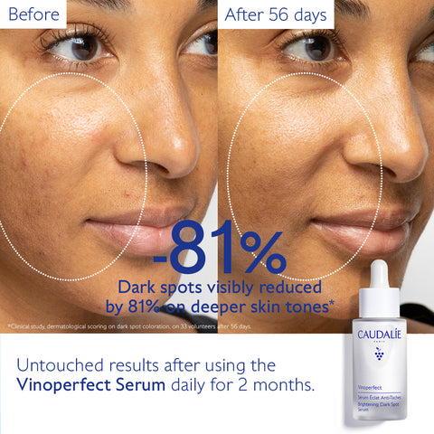 Caudalie Vinoperfect Brightening Dark Spot Serum 30ml