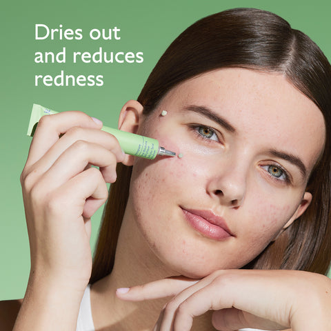 Caudalie Vinopure Salicylic Spot Solution