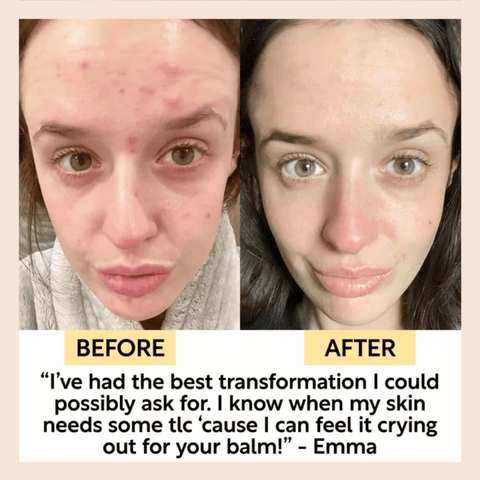 UpCircle Cleansing Face Balm with Oat Oil + Vitamin E - Travel Size