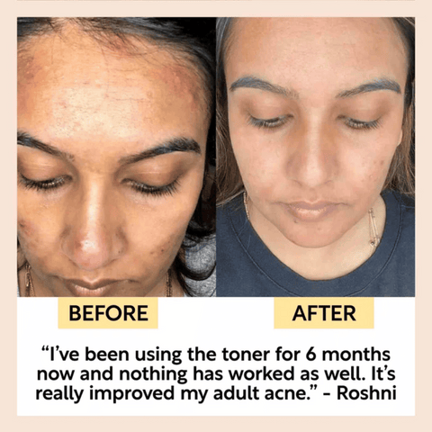 UpCircle Face Toner with Hyaluronic Acid 100ml