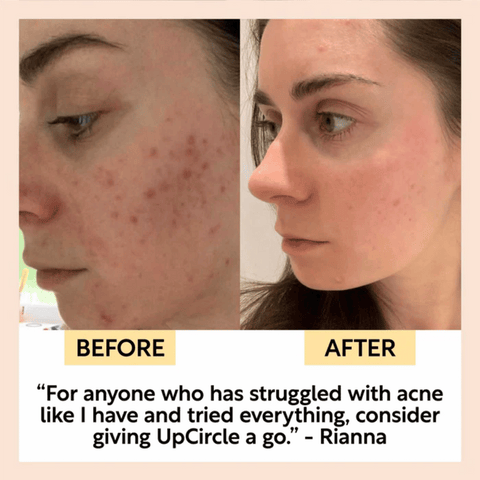 UpCircle Face Toner with Hyaluronic Acid 100ml