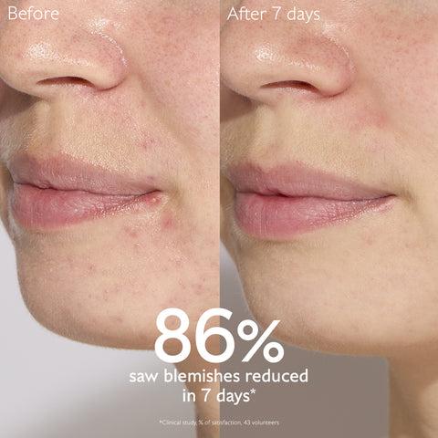 Caudalie Vinopure Blemish Control Salicylic Serum