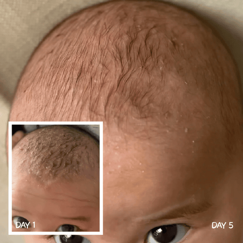 MooGoo Scalp Cream 120g