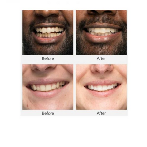Spotlight Oral Care Whitening Pro Toothpaste 100ml